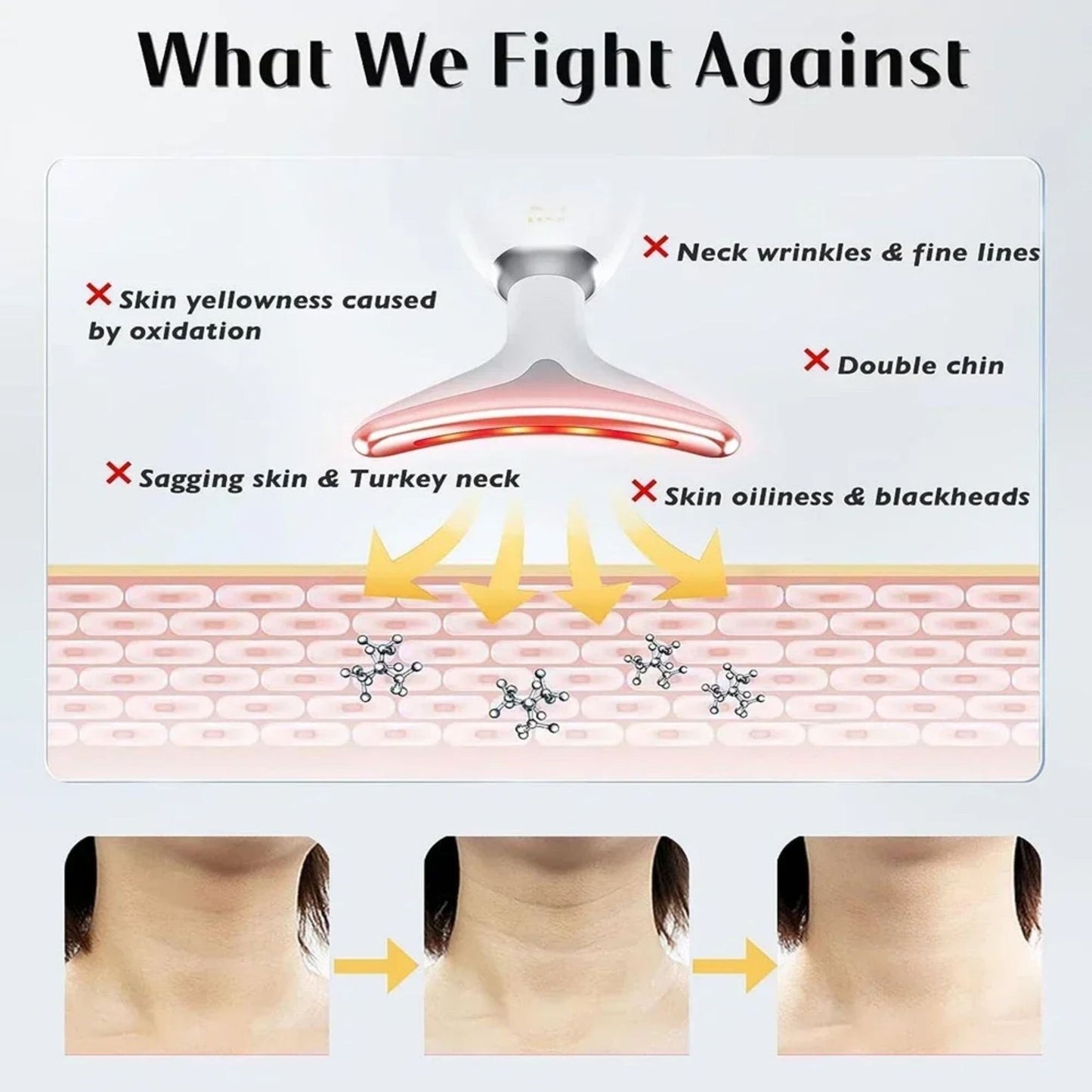 Red-Light-Therapy-for-Face and Neck